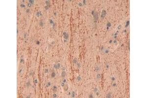 Used in DAB staining on fromalin fixed paraffin- embedded brain tissue (CADPS 抗体  (AA 1186-1352))