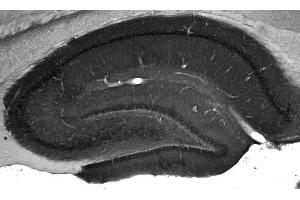 Adult rat hippocampus immunohistochemistry. (WASF1 抗体  (AA 477-498))