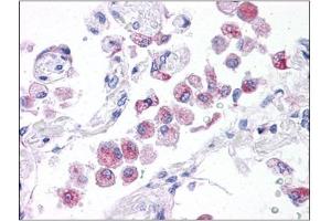 Human Lung: Formalin-Fixed, Paraffin-Embedded (FFPE) (NLRP14 抗体  (N-Term))
