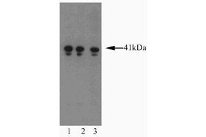 Western blot analysis of AIM-1 on a Jurkat cell lysate (Human T-cell leukemia, ATCC TIB-152). (Aurora Kinase B 抗体  (AA 2-124))