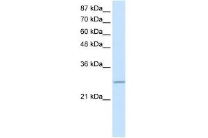 WB Suggested Anti-C20ORF20 Antibody Titration: 0. (MRGBP 抗体  (Middle Region))