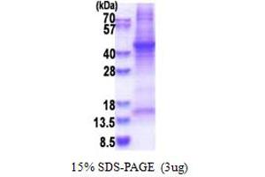 Haptoglobin Protein (HP) (AA 19-347) (His tag)