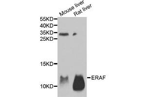 Western blot analysis of extracts of various cell lines, using AHSP antibody. (aHSP 抗体)