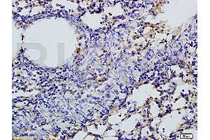 Formalin-fixed and paraffin embedded rat lung tissue labeled with Rabbit Anti-SGLT1 Polyclonal Antibody, Unconjugated (ABIN738066) 1:200 followed by conjugation to the secondary antibody and DAB staining (SLC5A1 抗体  (AA 401-500))