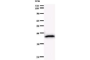 Western Blotting (WB) image for anti-BRCA1 Associated RING Domain 1 (BARD1) antibody (ABIN930988) (BARD1 抗体)