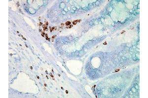 Immunohistochemistry analysis using Mouse Anti-Hsp70 Monoclonal Antibody, Clone C92 . (HSP70 抗体  (HRP))