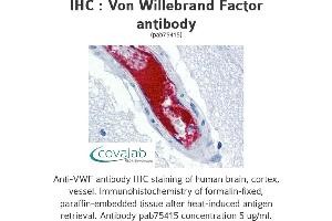 Image no. 1 for anti-Von Willebrand Factor (VWF) antibody (ABIN1740780) (VWF 抗体)