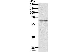Western blot analysis of Jurkat cell, using TRAF3IP2 Polyclonal Antibody at dilution of 1:500 (TRAF3IP2 抗体)
