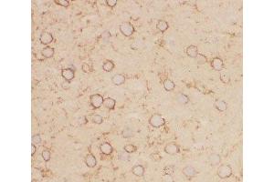 IHC-F staining of mouse brain tissue (Kv2.1/KCNB1 抗体  (AA 687-858))