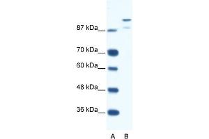 WB Suggested Anti-HKR1 Antibody Titration:  0. (HKR1 抗体  (N-Term))