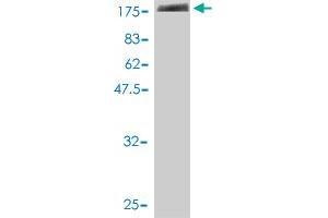 Western Blot detection against Immunogen (95.