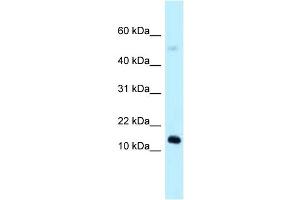 WB Suggested Anti-1110059E24Rik Antibody Titration: 1. (1110059E24Rik 抗体  (N-Term))
