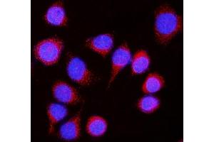 anti-Nicastrin (NCSTN) (AA 34-669) antibody