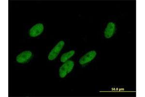Immunofluorescence of purified MaxPab antibody to ZNF777 on HepG2 cell. (ZNF777 抗体  (AA 1-518))
