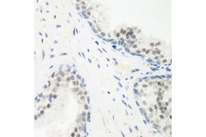 Immunohistochemistry of paraffin-embedded human prostate using PPAN antibody (ABIN6133157, ABIN6145994, ABIN6145996 and ABIN6223238) at dilution of 1:200 (40x lens). (PPAN 抗体  (AA 1-300))