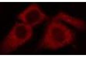 ABIN6275185 staining LOVO cells by IF/ICC.