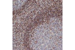 Immunohistochemistry (IHC) image for anti-B-Cell CLL/lymphoma 2 (BCL2) antibody (ABIN2477599) (Bcl-2 抗体)