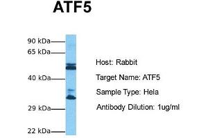 ATF5 抗体  (N-Term)
