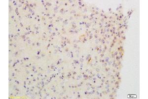 Formalin-fixed and paraffin embedded: Human brain glioma labeled with Anti-ChRM2 Polyclonal Antibody, Unconjugated  at1:200, followed by conjugation to the secondary antibody and DAB staining (Muscarinic Acetylcholine Receptor M2 抗体  (AA 381-466))