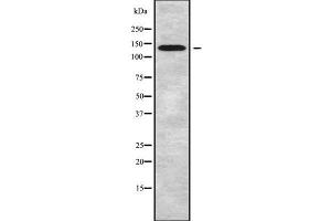 Western Blotting (WB) image for anti-ATPase, Ca++ Transporting, Plasma Membrane 2 (ATP2B2) (N-Term) antibody (ABIN6260123)