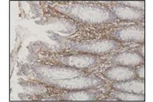 Paraformaldehyde-fixed paraffin-embedded biopsy from patient with confirmed colonic Crohn disease. (ATG16L1 抗体  (AA 84-114))