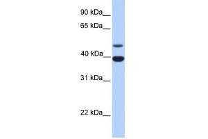 Inhibin Alpha antibody used at 1 ug/ml to detect target protein. (Inhibin alpha 抗体  (N-Term))