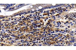 Detection of TLR5 in Rat Small intestine Tissue using Polyclonal Antibody to Toll Like Receptor 5 (TLR5) (TLR5 抗体  (AA 325-644))