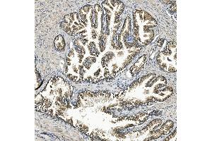 IHC analysis of Rex1/ZFP42 using anti-Rex1/ZFP42 antibody (ABIN7600901).