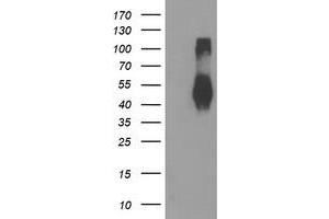 Western Blotting (WB) image for anti-Transmembrane Protein with EGF-Like and Two Follistatin-Like Domains 2 (TMEFF2) antibody (ABIN1501416) (TMEFF2 抗体)