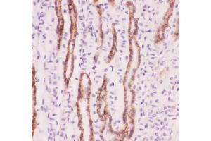Anti-SLC9A1 Picoband antibody,  IHC(P): Mouse Kidney Tissue