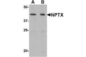 Western blot analysis of NPTX2 in mouse brain tissue lysate with NPTX2 antibody at (A) 0. (NPTX2 抗体  (Center))