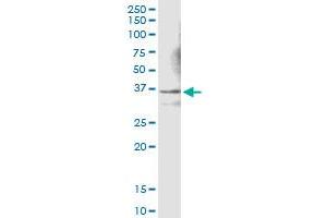 Immunoprecipitation of LDHC transfected lysate using anti-LDHC MaxPab rabbit polyclonal antibody and Protein A Magnetic Bead , and immunoblotted with LDHC MaxPab mouse polyclonal antibody (B01) . (Lactate Dehydrogenase C 抗体  (AA 1-332))