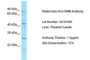 Host: Rabbit Target Name: HLA-DMB Sample Type: Human Placenta Antibody Dilution: 1. (HLA-DMB 抗体  (N-Term))