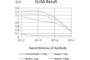 Black line: Control Antigen (100 ng),Purple line: Antigen (10 ng), Blue line: Antigen (50 ng), Red line:Antigen (100 ng) (ACRV1 抗体  (AA 22-265))