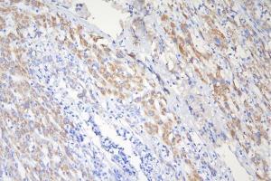 IHC analysis of TSC2 using anti-TSC2 antibody (ABIN7600203). (Tuberin 抗体  (AA 1611-1807))