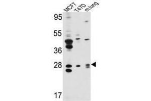 Image no. 1 for anti-E74-Like Factor 5 (Ets Domain Transcription Factor) (ELF5) (Middle Region) antibody (ABIN452951) (ELF5 抗体  (Middle Region))