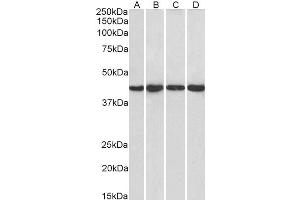 Western Blotting (WB) image for anti-Protein Phosphatase 1, Regulatory Subunit 8 (PPP1R8) antibody (ABIN5930543) (PPP1R8 抗体)