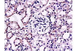 Formalin-fixed and paraffin embedded: rat kidney tissue labeled with Anti-fg-12 Polyclonal Antibody (ABIN727785), Unconjugated at 1:200, followed by conjugation to the secondary antibody and DAB staining (FGL2 抗体  (AA 75-150))
