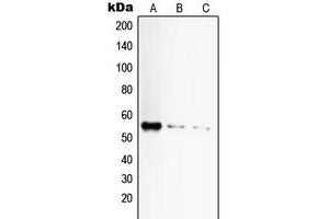 Western blot analysis of CD120a expression in HeLa (A), mouse liver (B), rat liver (C) whole cell lysates. (TNFRSF1A 抗体  (C-Term))