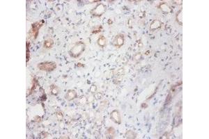 Immunohistochemistry of paraffin-embedded human kidney tissue using ABIN7147023 at dilution of 1:100 (Cathepsin S 抗体  (AA 115-331))