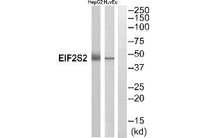 Western blot analysis of extracts from HepG2 cells and HuvEc cells, using EIF2S2 antibody.