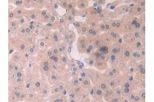Detection of XDH in Mouse Liver Tissue using Polyclonal Antibody to Xanthine Dehydrogenase (XDH) (XDH 抗体  (AA 231-416))