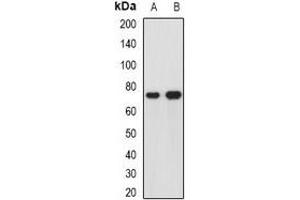 Western blot analysis of hnRNP R expression in Hela (A), HepG2 (B) whole cell lysates. (HNRNPR 抗体)