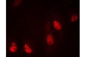 Immunofluorescent analysis of RPL36 staining in MDAMB435 cells. (RPL36 抗体  (Center))
