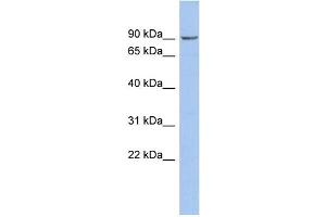 WB Suggested Anti-NPHP1 Antibody Titration: 0. (NPHP1 抗体  (Middle Region))