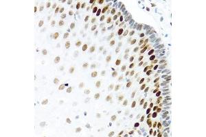 Immunohistochemistry of paraffin-embedded human esophagus using KHDRBS2 antibody.