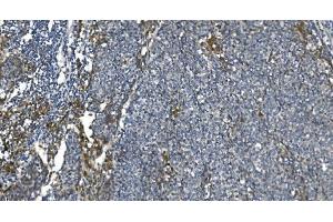IHC analysis of eRF1/ETF1 using anti-eRF1/ETF1 antibody (ABIN7602625).