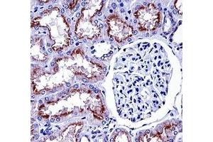 NOX4 antibody immunohistochemistry analysis in formalin fixed and paraffin embedded human kidney tissue. (NADPH Oxidase 4 抗体  (AA 124-153))