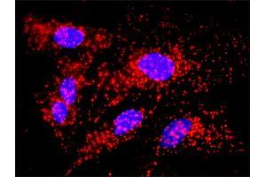 Proximity Ligation Analysis of protein-protein interactions between CALR and APP.
