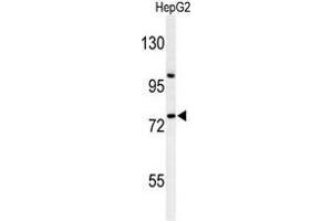 Western blot analysis of ZNF202 Antibody (Center) in HepG2 cell line lysates (35 µg/lane). (ZNF202 抗体  (Middle Region))